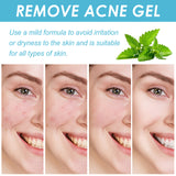 Salicylate Acne Repair Gel
