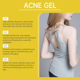 Waist Acne Gel Skin Cleansing