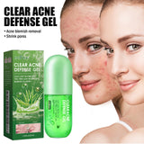 Acne Care Gel Reduces Acne